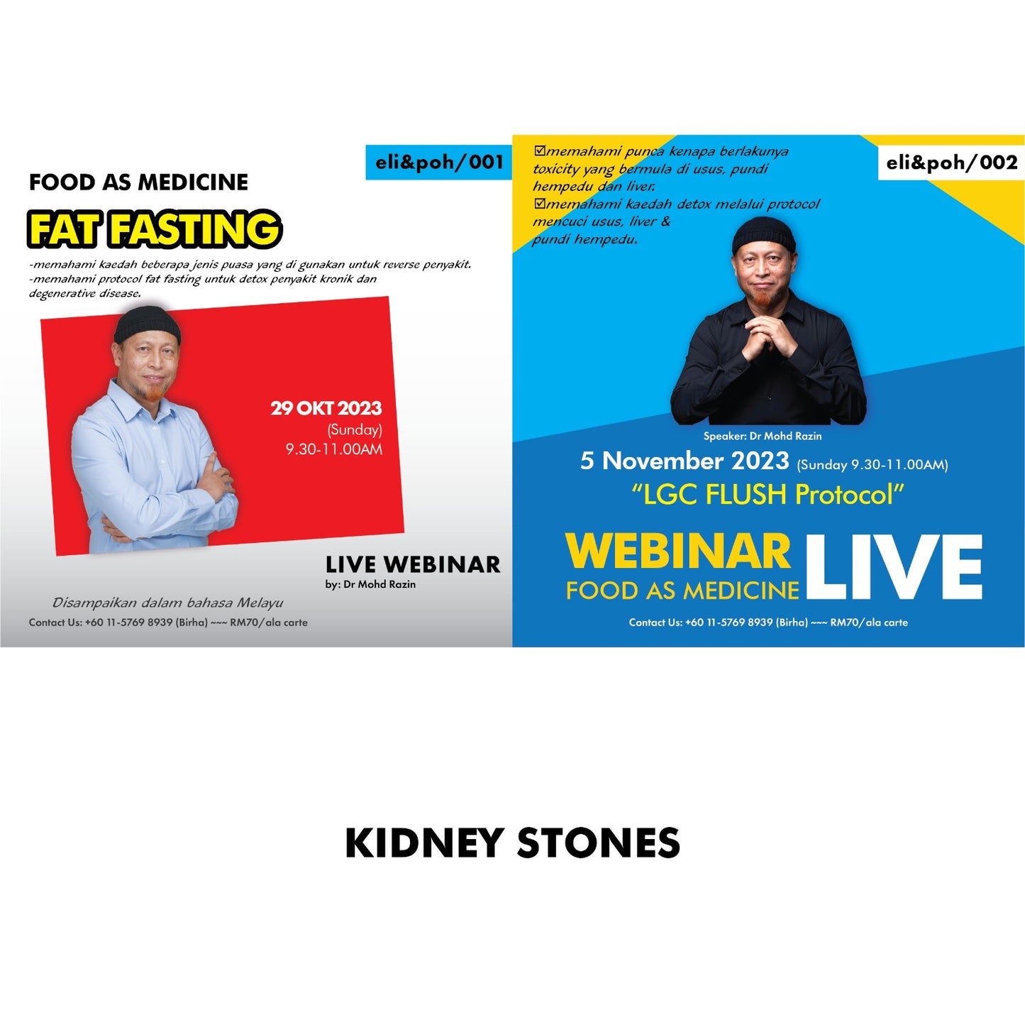 Package: Kidney Stones | Webinar by Dr Razin Jaafar